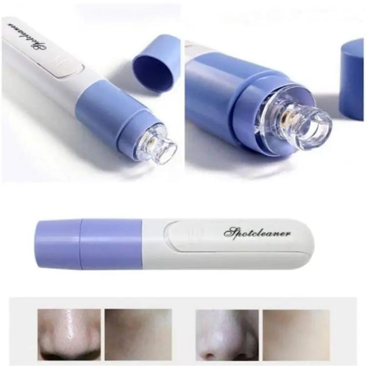 New Electric Blackhead Remover